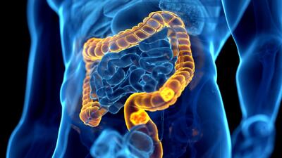  روشی امیدوارکننده برای کاهش رشد سرطان روده بزرگ و افزایش شانس بقا